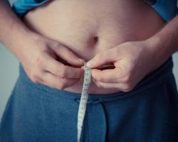The myth of “healthy" obesity
